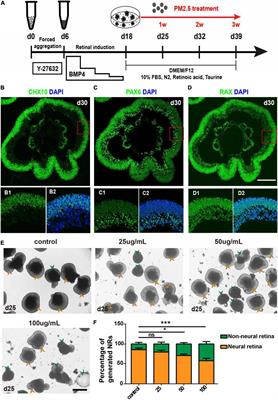 The Impact of Particulate Matter (PM2.5) on Human Retinal Development in hESC-Derived Retinal Organoids